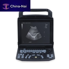 Portable ultrasound system YSB-M5for multipurpose ultrasound imagingB/Wbuilt-in console