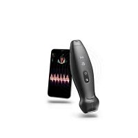 Hand-held ultrasound system TE Air for emergency medicine ultrasound imagingB/Wcolor doppler
