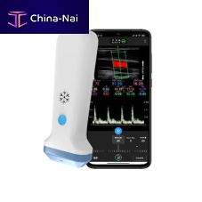 Hand-held ultrasound system S35Lfor emergency medicine ultrasound imagingfor breast ultrasound imagingfor musculoskeletal ultrasound imaging