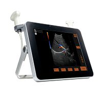 Portable ultrasound system EvoTouch+for multipurpose ultrasound imagingcolor dopplerB/W
