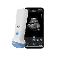 Hand-held ultrasound system S35Cfor gynecological and obstetric ultrasound imagingfor abdominal and pelvic ultrasound imagingfor emergency medicine ultrasound imaging
