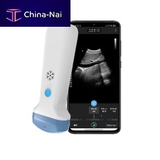 Hand-held ultrasound system S35Cfor gynecological and obstetric ultrasound imagingfor abdominal and pelvic ultrasound imagingfor emergency medicine ultrasound imaging