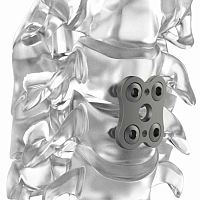 Cervical arthrodesis plate PM BUTTERFLY®lockingtitanium2 levels