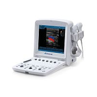 Portable ultrasound system DUS-5000for gynecological and obstetric ultrasound imagingfor abdominal and pelvic ultrasound imagingfor cardiovascular ultrasound imaging
