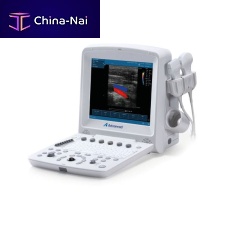 Portable ultrasound system DUS-5000for gynecological and obstetric ultrasound imagingfor abdominal and pelvic ultrasound imagingfor cardiovascular ultrasound imaging