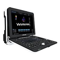 Multipurpose ultrasound imaging system DW-P8portableB/Wcolor doppler