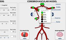 Hospital software NewroSimclinicalcardiovascularneurological