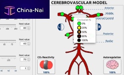Hospital software NewroSimclinicalcardiovascularneurological