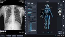 X-ray imaging software for controlacquisitionautomated