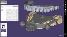 Dental software exocad designCADWindows