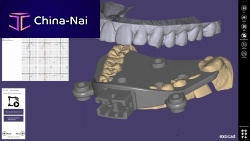 Dental software exocad designCADWindows