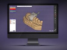 Dental software iCAM oneCADdental
