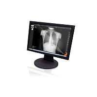 Radiology software Xview4visualizationfor tablet PC