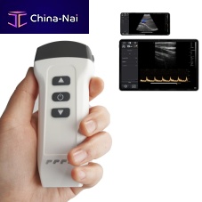 Hand-held ultrasound system DW-X1for gynecological and obstetric ultrasound imagingfor abdominal and pelvic ultrasound imagingfor musculoskeletal ultrasound imaging