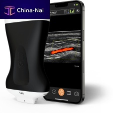 Hand-held ultrasound system L20 HD3for musculoskeletal ultrasound imagingfor ophthalmic ultrasound imagingfor skin ultrasound imaging