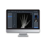 Radiography software ADAMacquisitiontreatmentWindows