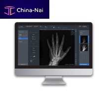 Radiography software ADAMacquisitiontreatmentWindows