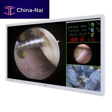 Diagnostic display Medical Monitordentallaparoscopyfor hysteroscopy