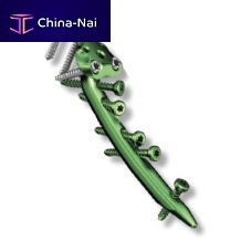 Radius intramedullary nail Charfix2distal fixationtitanium
