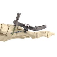 Tarso-metatarsal joint arthrodesis screw InCore®headless