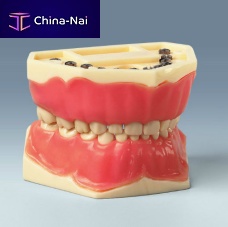 Denture model AK-6/2for teachingchild
