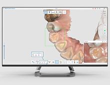 Dental software clinicalscanAI