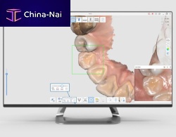 Dental software clinicalscanAI