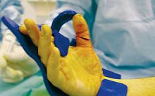 Orthopedic surgery hand support KIROFIX Large