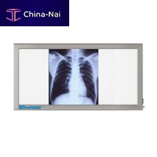 3-screen X-ray film viewer NT 130white light