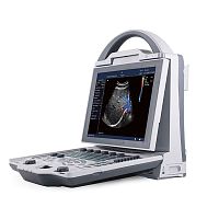 Portable ultrasound system YSB-DU12for multipurpose ultrasound imagingB/Wcolor doppler