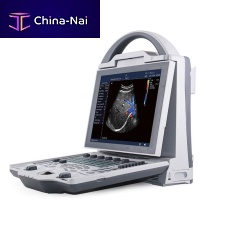 Portable ultrasound system YSB-DU12for multipurpose ultrasound imagingB/Wcolor doppler