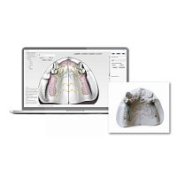 Medical software iPDdentaldesignscan