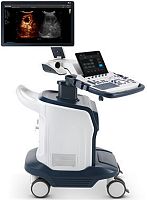 On-platform ultrasound system S60for multipurpose ultrasound imagingcolor doppler3D/4D