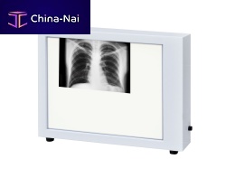 1-screen X-ray film viewer N-1verticalLED