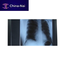 1-screen X-ray film viewer LED