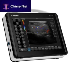 Portable ultrasound system BLUEfor multipurpose ultrasound imagingB/Wcolor doppler