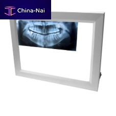 1-screen X-ray film viewer XLDS08W2-screen3-screendental