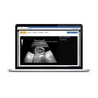 Medical imaging software Sonoscanneranalysis