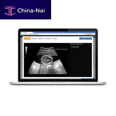 Medical imaging software Sonoscanneranalysis