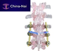 Cervico-thoraco-lumbo-sacral osteosynthesis unit EVOLUTION PLUSposterioradult