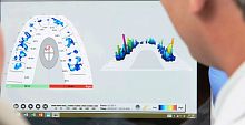 Dental software T-Scan Novus Coreuniversalanalysisvisualization