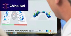 Dental software T-Scan Novus Coreuniversalanalysisvisualization