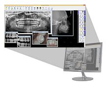 Dental imaging software dentalvisualizationanalysis