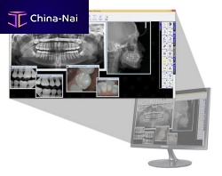 Dental imaging software dentalvisualizationanalysis