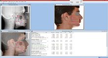 Medical imaging software Dr. Cephorthodonticsurgicalcephalometric analysis