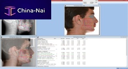 Medical imaging software Dr. Cephorthodonticsurgicalcephalometric analysis
